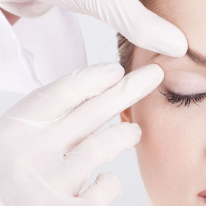 8 tips sobre la blefaroplastia