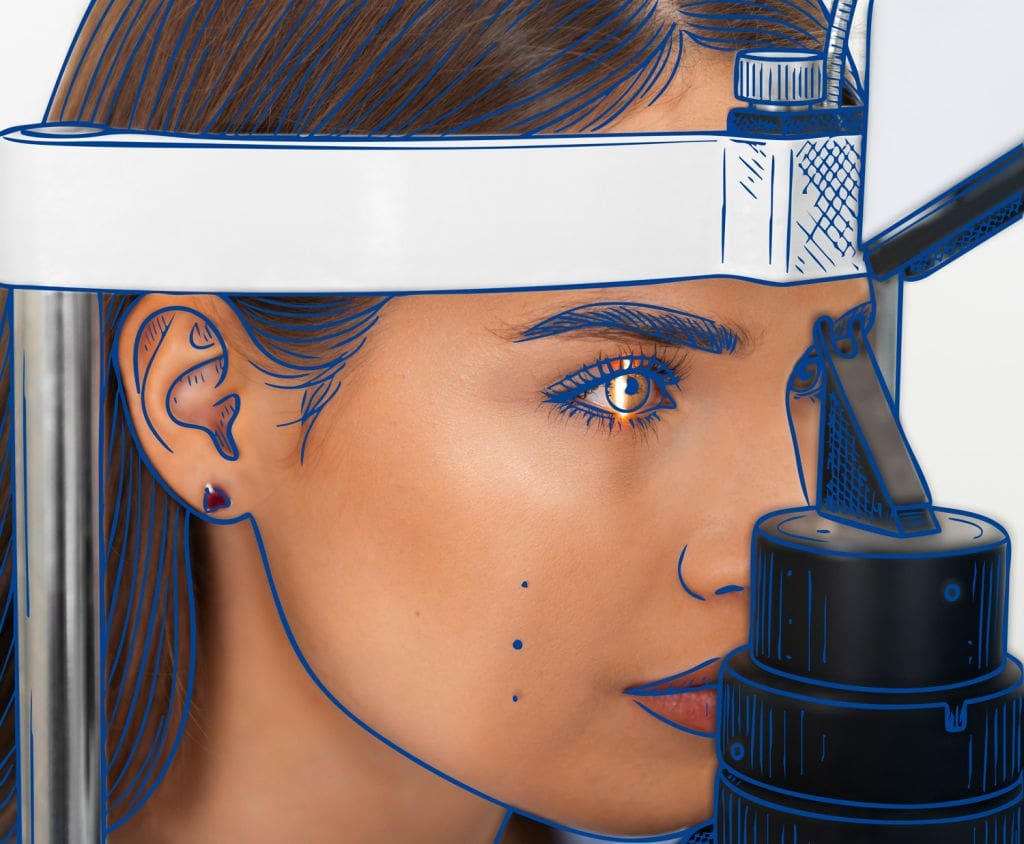 Cirugía Refractiva Corneal - Fundonal