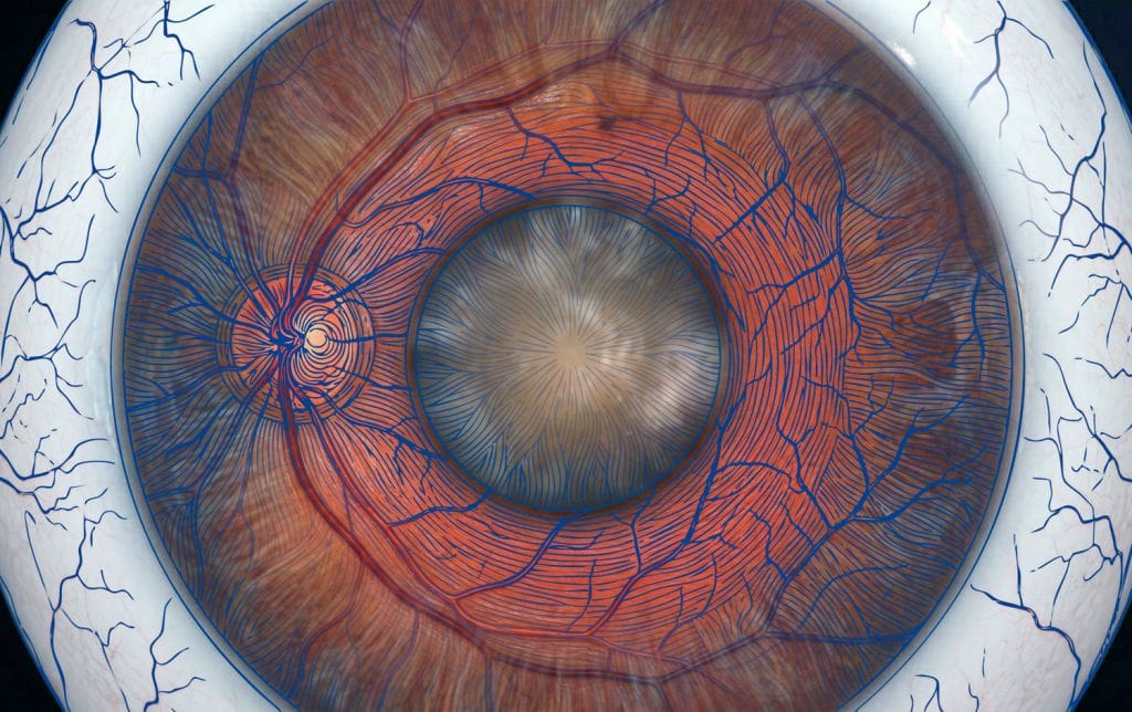 Exámenes de Catarata - Fundonal