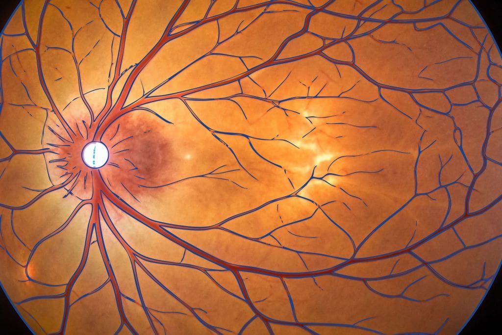 Retina y Vítreo - Fundonal